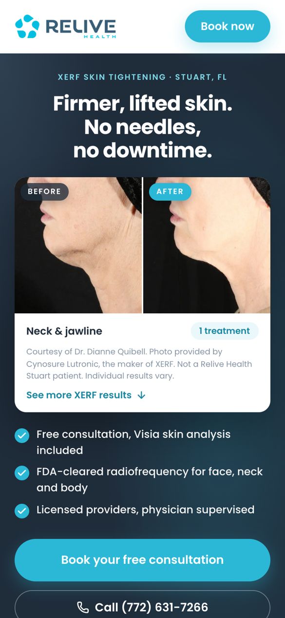 Skin tightening landing page